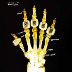 Kobe Bryant 5 Rings Hand X Ray Cool Los Angeles Basketball Fan T Shirt 37461914