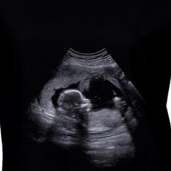 Sonogram Baby Ultrasound Ladies T Shirt 36224854