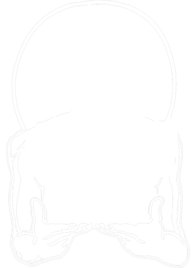 image overlay
